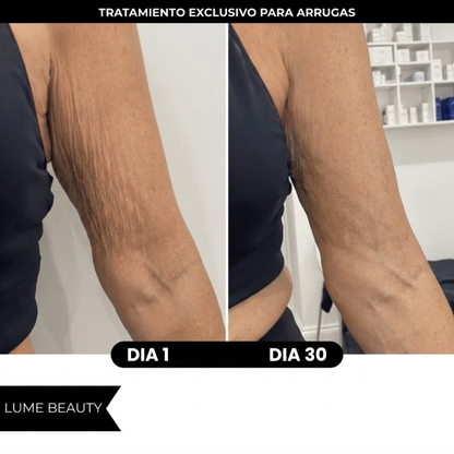 Aceite Anticelulitis - Adiós Flacidez y Arrugas