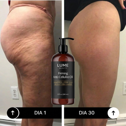 Aceite Anticelulitis - Adiós Flacidez y Arrugas